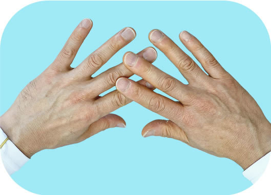 アプライドキネシオロジー（筋肉反射テスト）